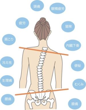 骨盤矯正